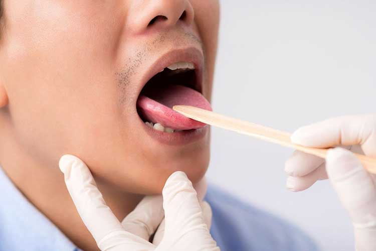 مراقبت های لازم پس از بیوپسی از دهان