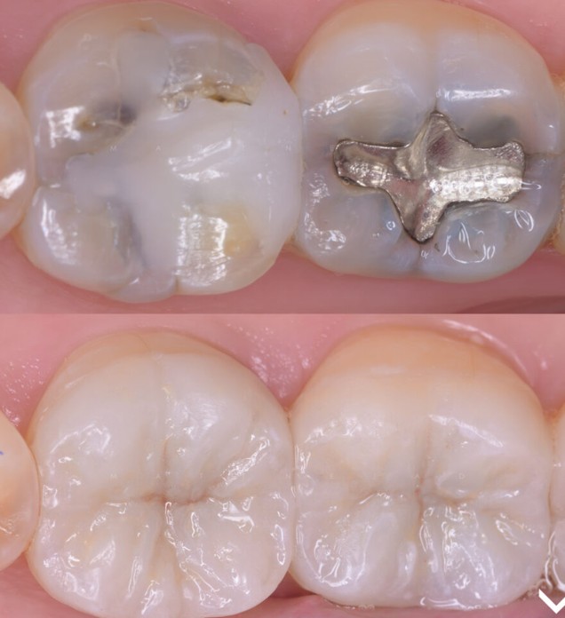 دندانپزشکی بیومیمتیک