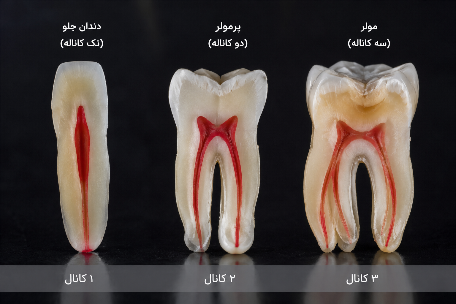 هزینه عصب کشی دندان در تهران کلینیک شریعتی میرداماد